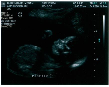 Our first ultrasound of Eli, he was such a busy boy punching his Momma's insides. 
