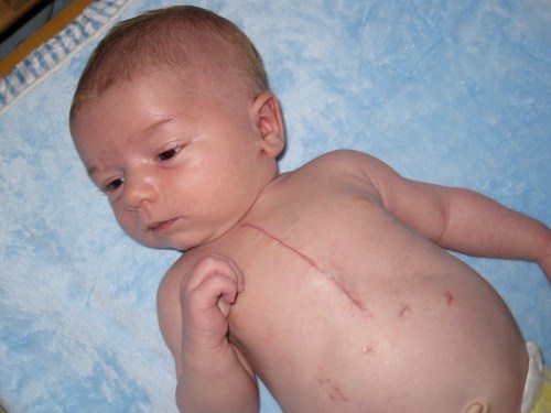 Getting big, strong and doing lots of healing!! His scars look fantastic! 