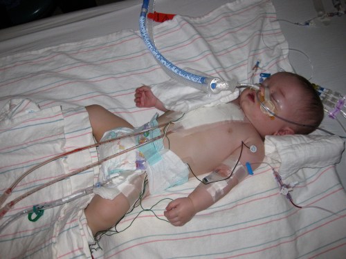 Just hours after his 2nd heart surgery. 